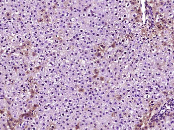 Apolipoprotein E Rabbit Polyclonal Antibody