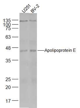 Apolipoprotein E Rabbit Polyclonal Antibody