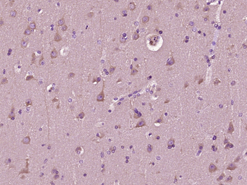 MAP2 Rabbit Polyclonal Antibody