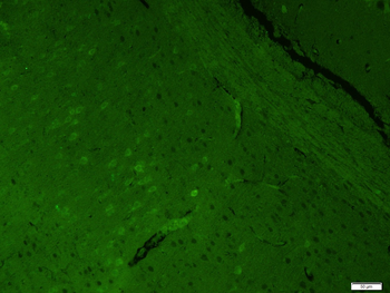 MAP2 Rabbit Polyclonal Antibody