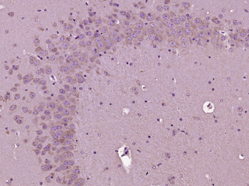 MAP2 Rabbit Polyclonal Antibody