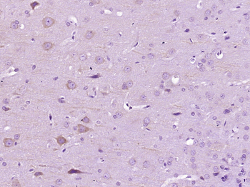 MAP2 Rabbit Polyclonal Antibody