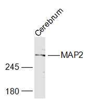 MAP2 Rabbit Polyclonal Antibody