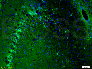 MAP2 Rabbit Polyclonal Antibody