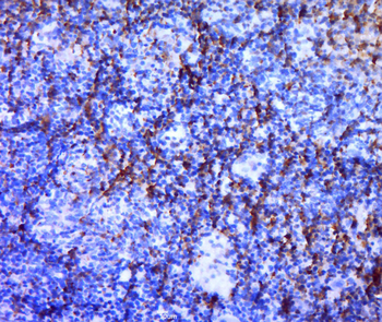 TERT Rabbit Polyclonal Antibody