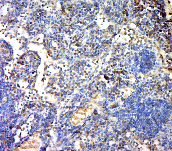 TERT Rabbit Polyclonal Antibody