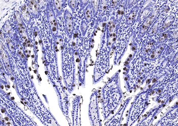 TFF3 Rabbit Polyclonal Antibody