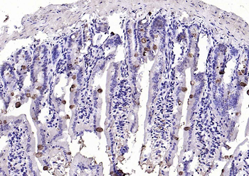 TFF3 Rabbit Polyclonal Antibody