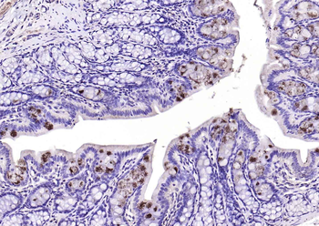 TFF3 Rabbit Polyclonal Antibody