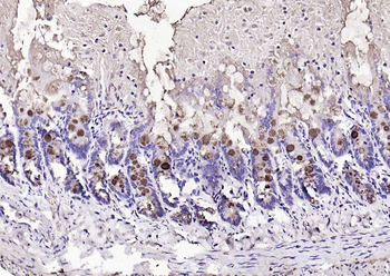 TFF3 Rabbit Polyclonal Antibody