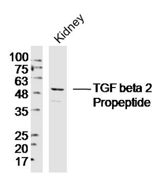 TGF beta 2 Propeptide Rabbit Polyclonal Antibody