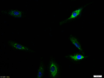 TIE2 Rabbit Polyclonal Antibody