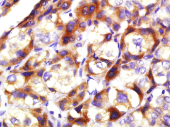 TIG2 Rabbit Polyclonal Antibody