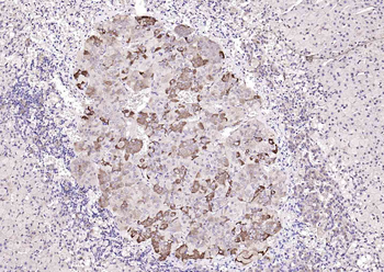 TIG2 Rabbit Polyclonal Antibody