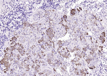 TIG2 Rabbit Polyclonal Antibody