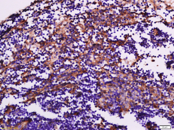 TIG2 Rabbit Polyclonal Antibody