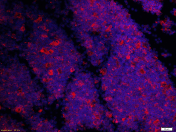 TIG2 Rabbit Polyclonal Antibody