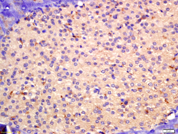 TIG2 Rabbit Polyclonal Antibody