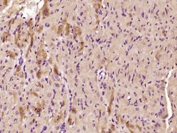 TIMP-4 Rabbit Polyclonal Antibody