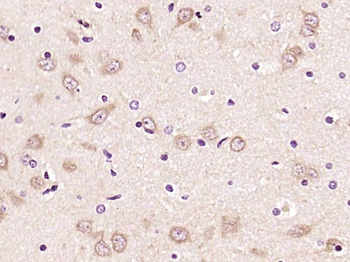 TLR2 Rabbit Polyclonal Antibody