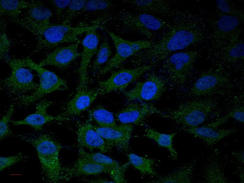 TLR4 Rabbit Polyclonal Antibody