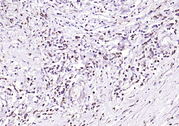 TLR4 Rabbit Polyclonal Antibody