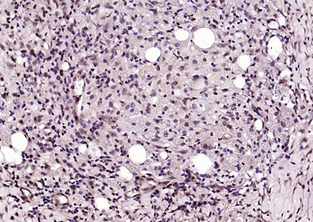 P53 (Acetyl K382) Rabbit Polyclonal Antibody