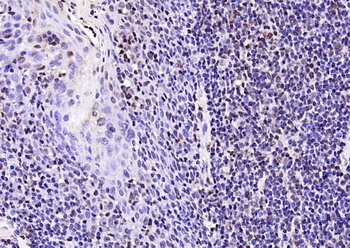 P53 (Acetyl K382) Rabbit Polyclonal Antibody