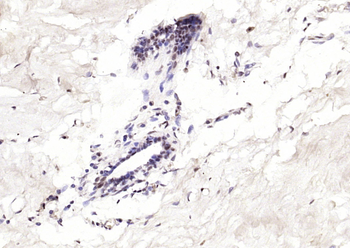 P53 (Acetyl K382) Rabbit Polyclonal Antibody