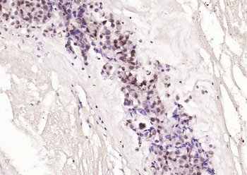 P53 (Acetyl K382) Rabbit Polyclonal Antibody