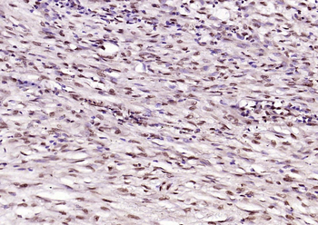 P53 (Acetyl K382) Rabbit Polyclonal Antibody