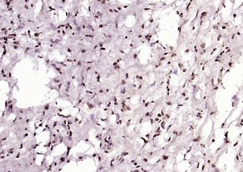 P53 (Acetyl K382) Rabbit Polyclonal Antibody