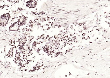 P53 (Acetyl K382) Rabbit Polyclonal Antibody