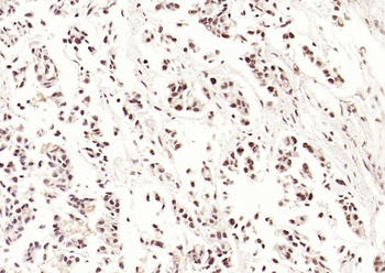 P53 (Acetyl K382) Rabbit Polyclonal Antibody