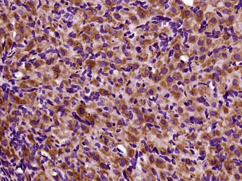 TOP2A Rabbit Polyclonal Antibody