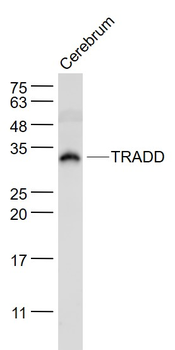 TRADD Rabbit Polyclonal Antibody