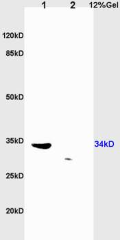 TRADD Rabbit Polyclonal Antibody