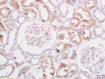 TRADD Rabbit Polyclonal Antibody