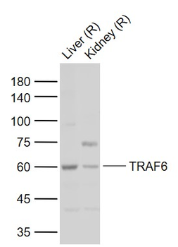 TRAF6 Rabbit Polyclonal Antibody