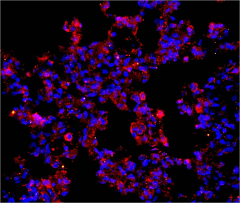 TRAF6 Rabbit Polyclonal Antibody