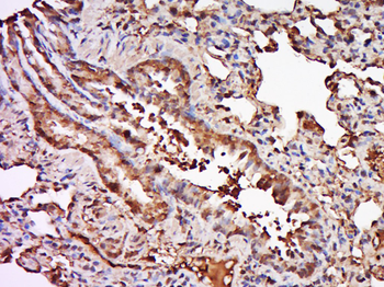 TRAF6 Rabbit Polyclonal Antibody