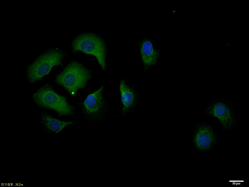 TTR/Prealbumin Rabbit Polyclonal Antibody