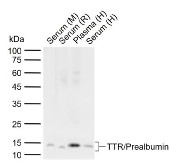 TTR/Prealbumin Rabbit Polyclonal Antibody