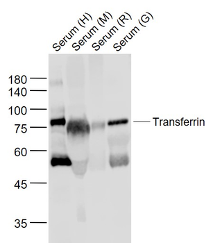 Transferrin Rabbit Polyclonal Antibody