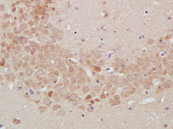 TrkA Rabbit Polyclonal Antibody