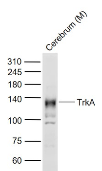 TrkA Rabbit Polyclonal Antibody