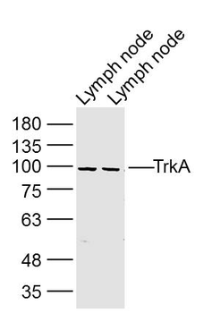 TrkA Rabbit Polyclonal Antibody
