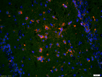 TrkA Rabbit Polyclonal Antibody