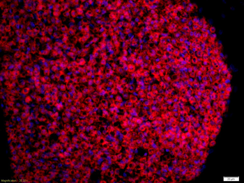 TrkA Rabbit Polyclonal Antibody