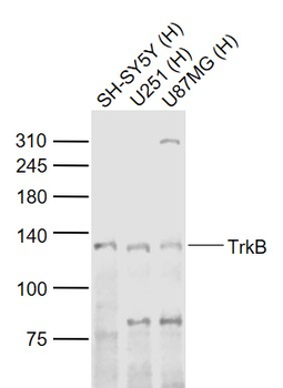 TrkB Rabbit Polyclonal Antibody